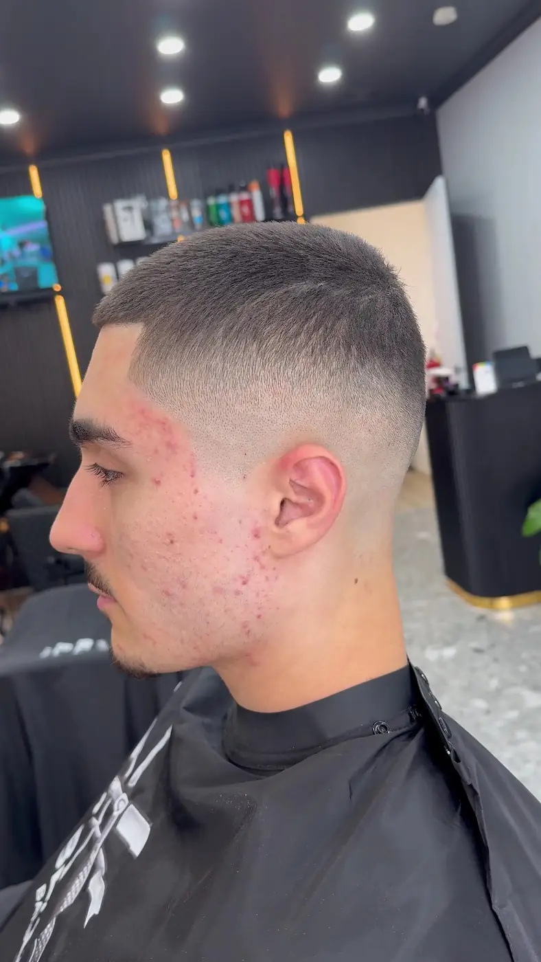 Skin fades